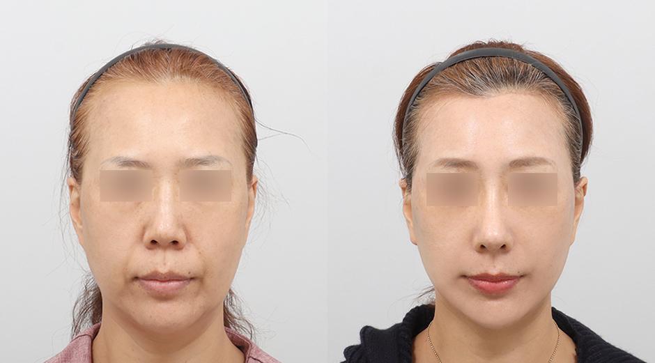 AB Plastic Surgery