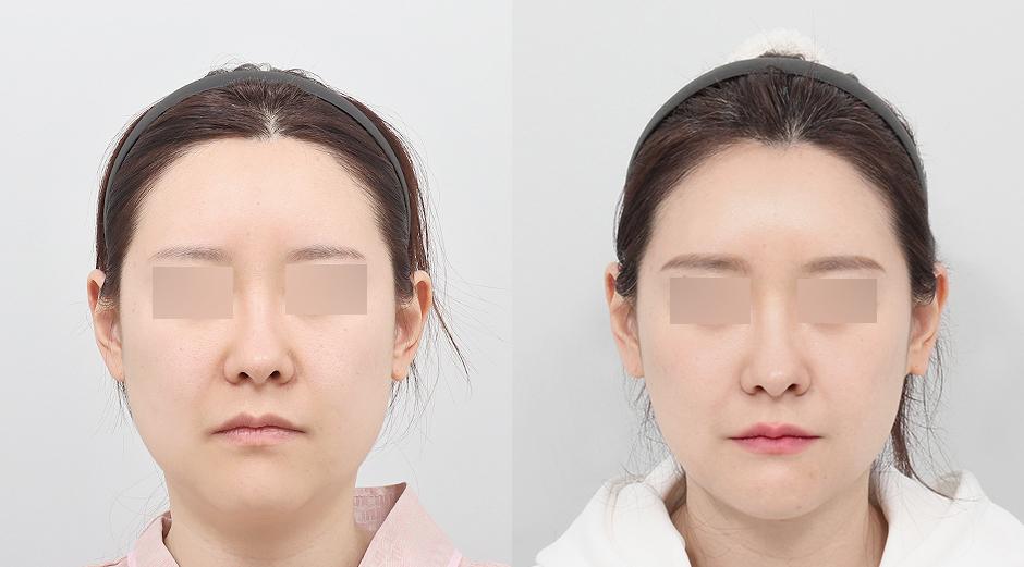 AB Plastic Surgery