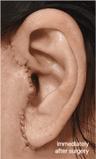 Skill matters in post-surgery scarring too. 2