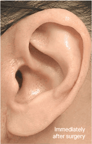 Skill matters in post-surgery scarring too. 2