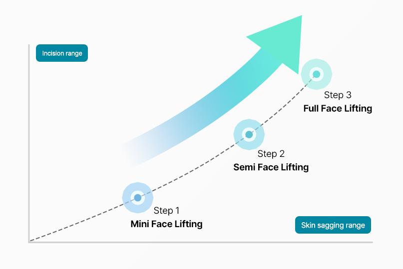 Customized three-stage facelift tension graph