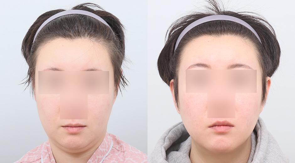 AB Plastic Surgery