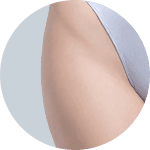 Liposuction result 5