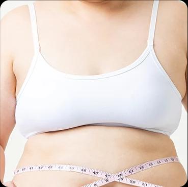 Obesity-related macromastia