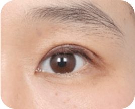 The Key to Beautiful Eyes