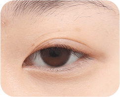 The Key to Beautiful Eyes