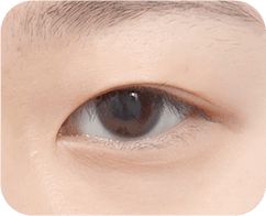 The Key to Beautiful Eyes