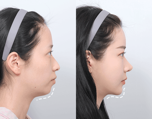 Personalized Design Considering the Entire Face