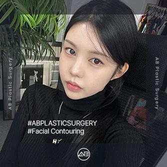 Facial Contouring