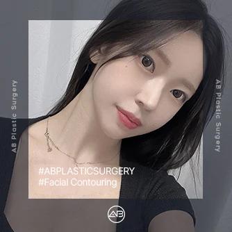 Facial Contouring