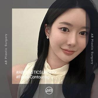 Facial Contouring