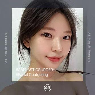 Facial Contouring