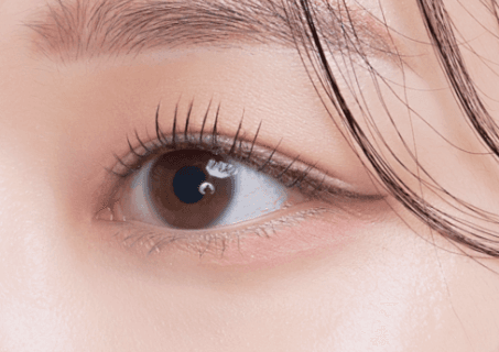 Eyelid Surgery