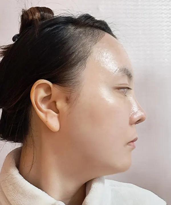 Make Me Girl before and after photo