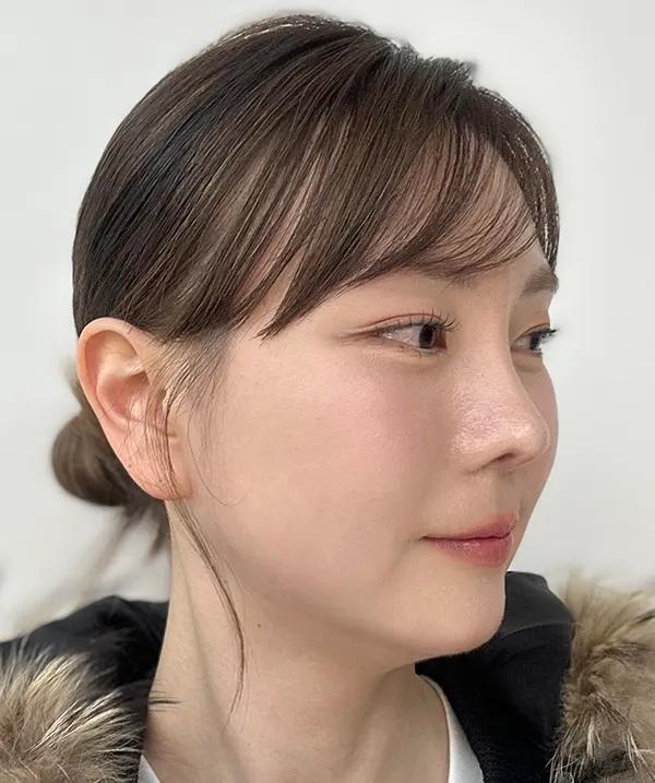 Make Me Girl before and after photo