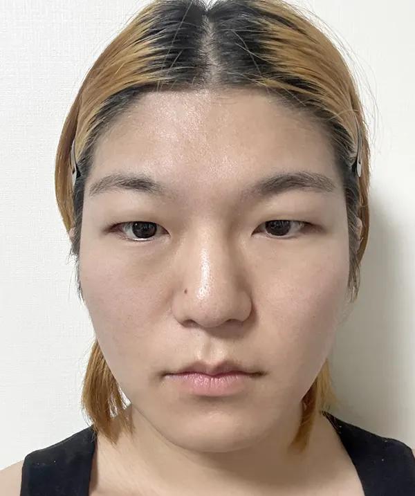 Make Me Girl before and after photo