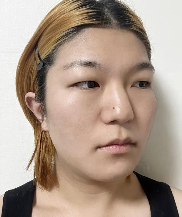 Make Me Girl before and after photo