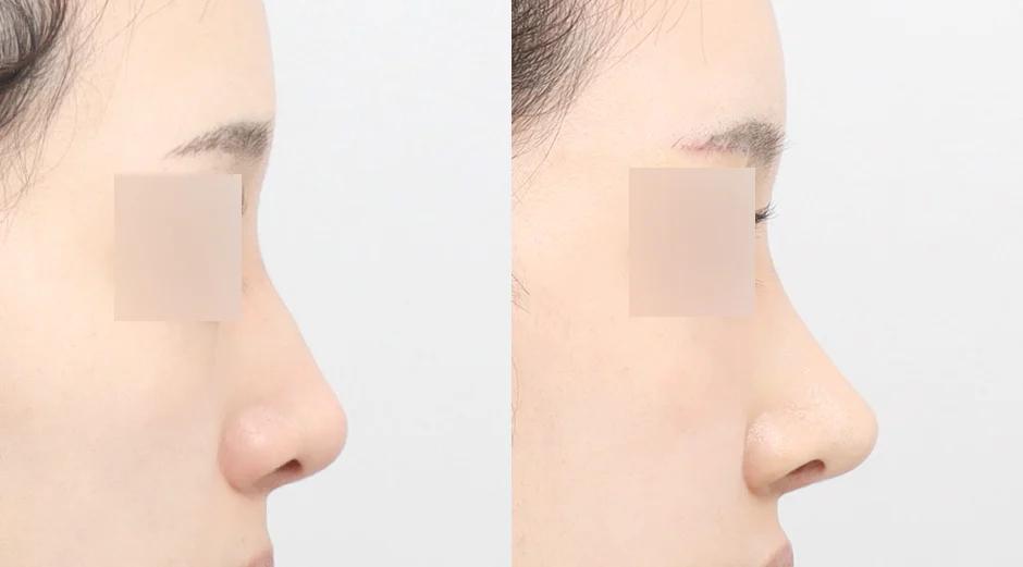 AB Plastic Surgery