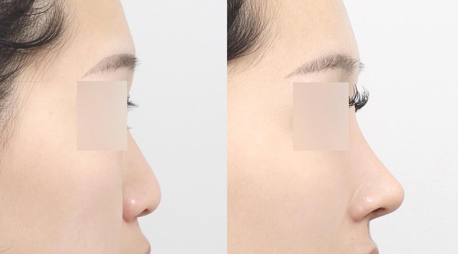 AB Plastic Surgery