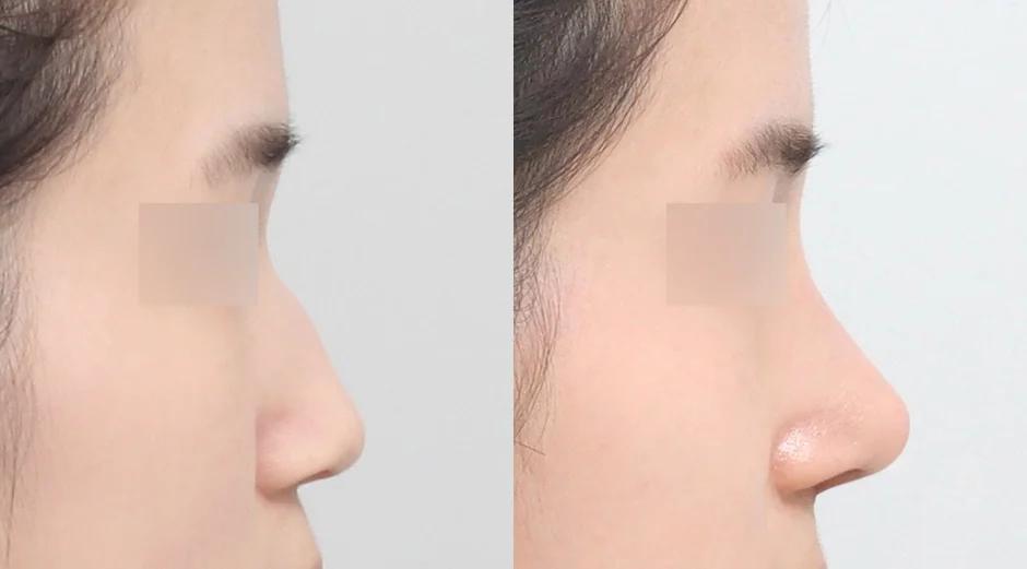AB Plastic Surgery