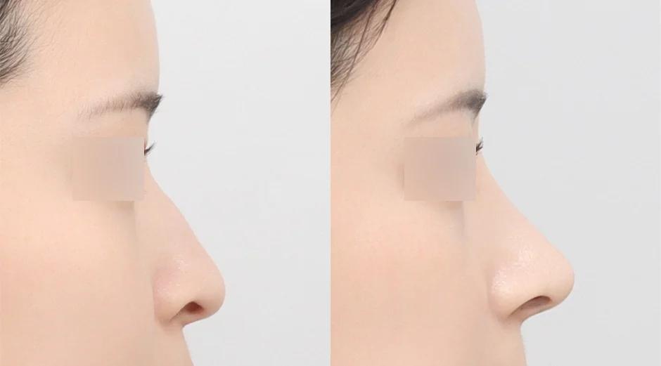 AB Plastic Surgery