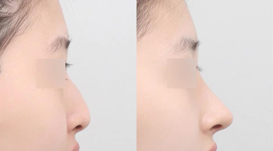 AB Plastic Surgery