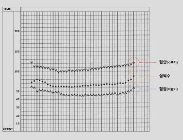 Real time monitoring after anesthesia and surgery for emergency preparedness