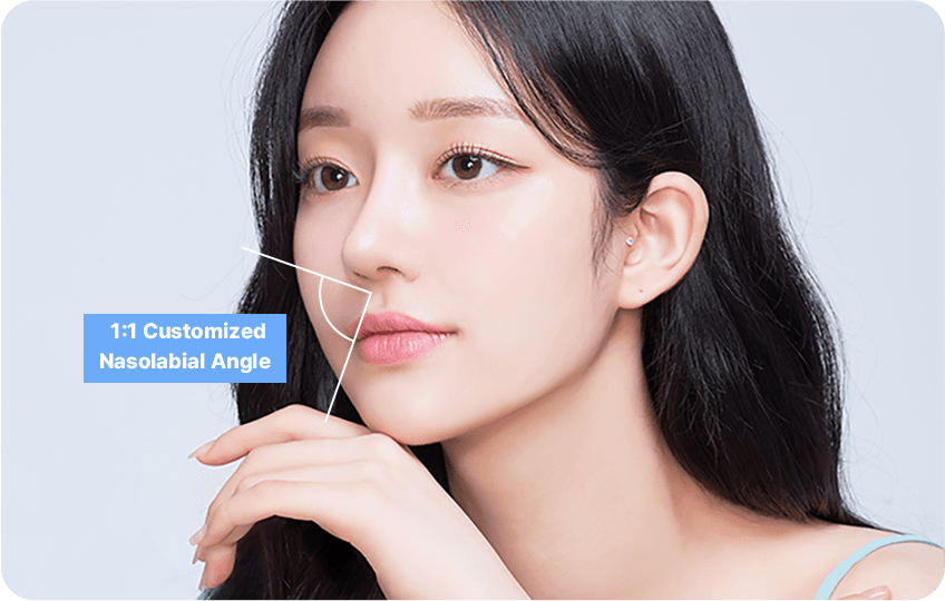 1:1 customized nasolabial angle