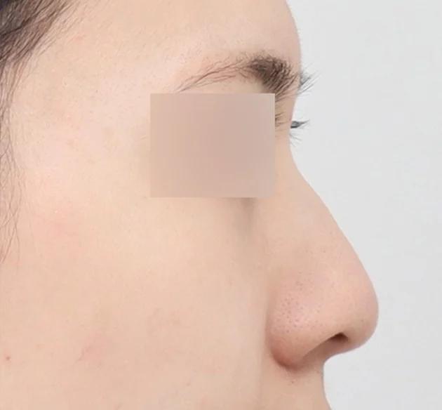 Glamorous nose tip before