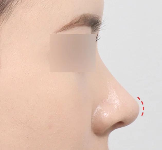 Glamorous nose tip after