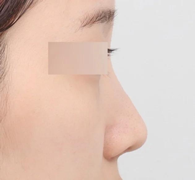 NaturGlow customized Columella line before