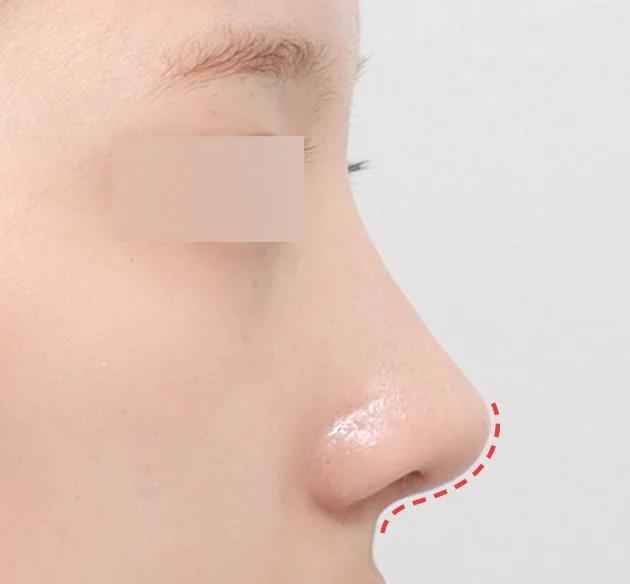 NaturGlow customized Columella line after