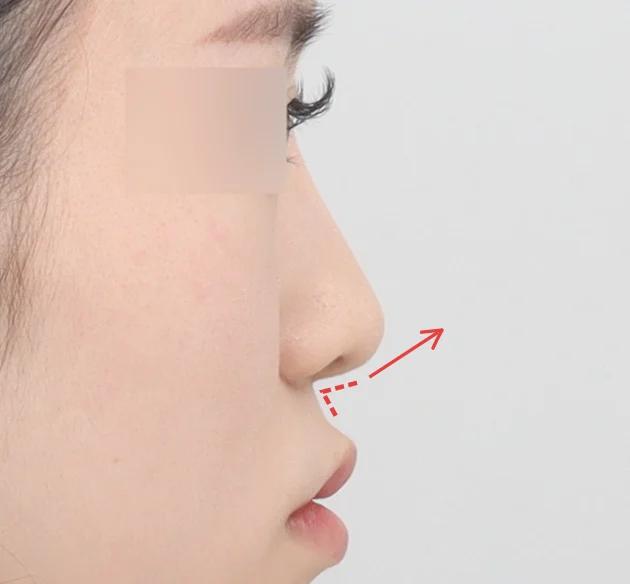 Sophisticated and dimensional facial proportions before