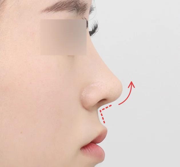 Sophisticated and dimensional facial proportions after