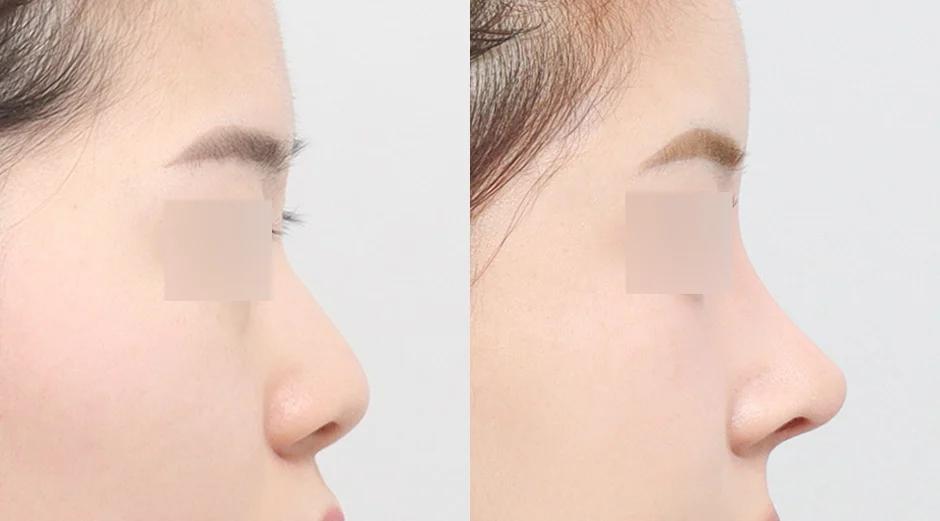 AB Plastic Surgery