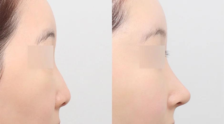 AB Plastic Surgery