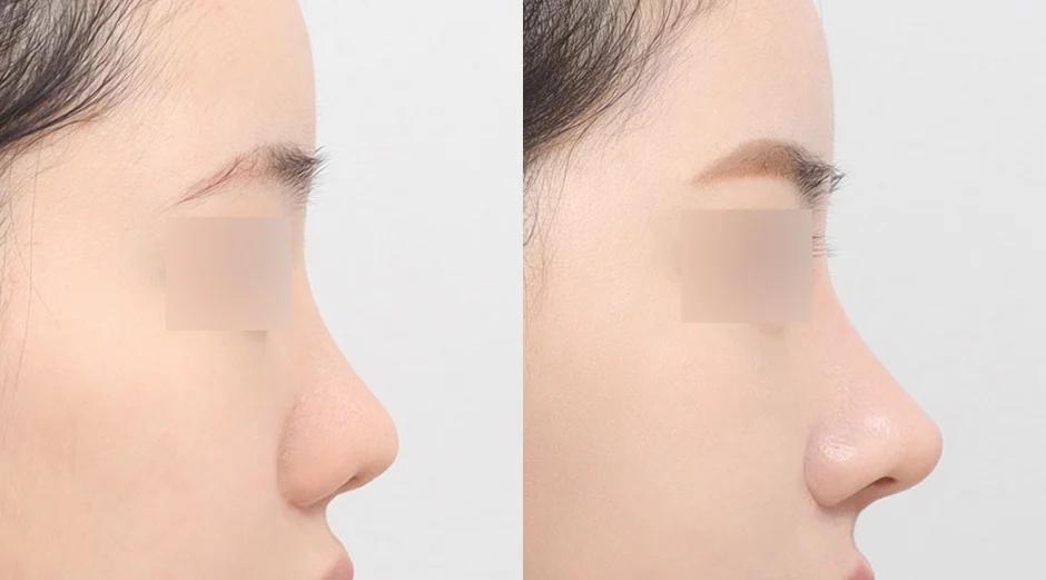 AB Plastic Surgery