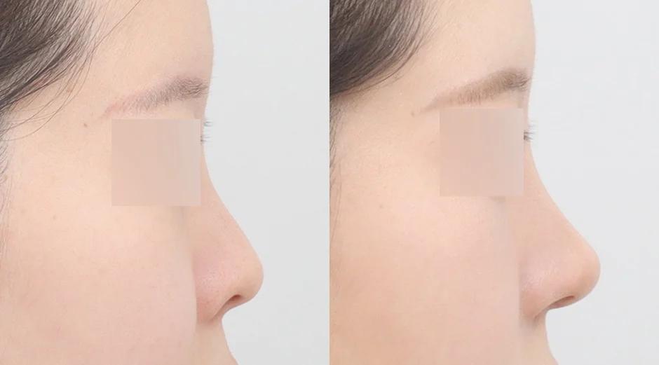 AB Plastic Surgery
