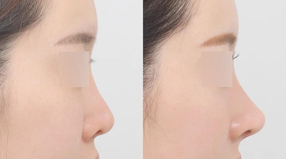 AB Plastic Surgery