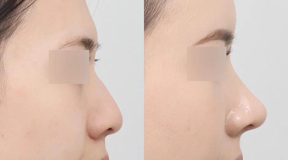 AB Plastic Surgery