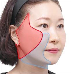Full Face Lifting
