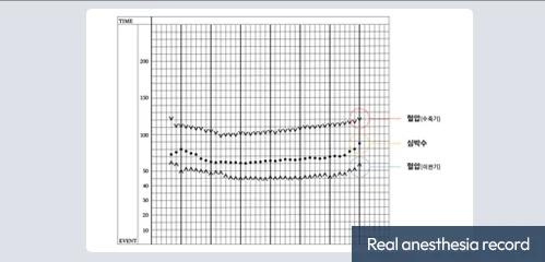 Real anesthesia record