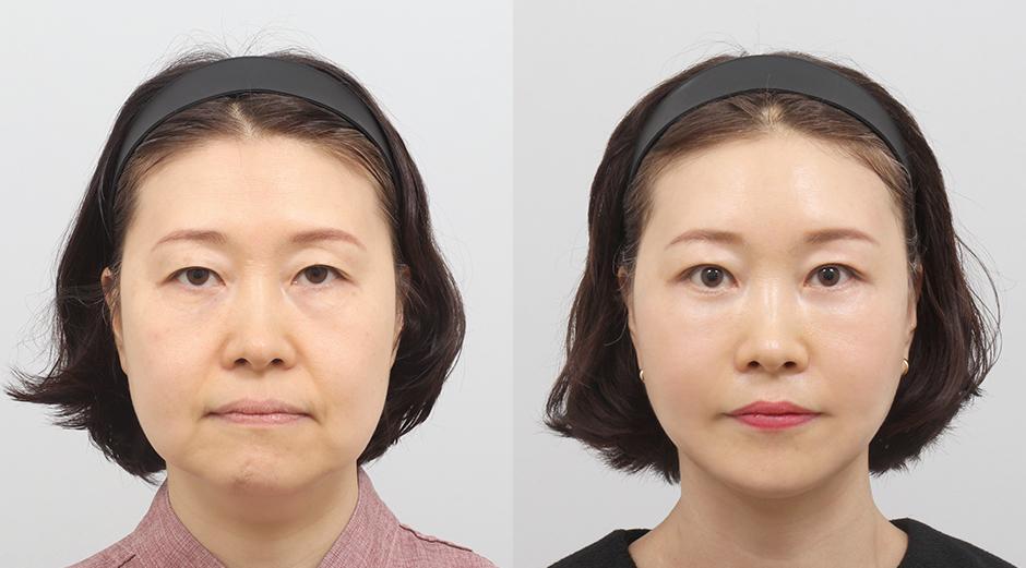 AB Plastic Surgery