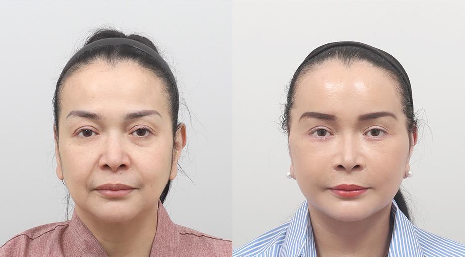 AB Plastic Surgery