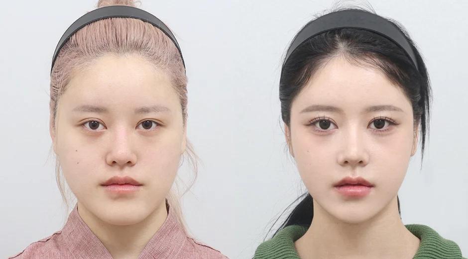 AB Plastic Surgery