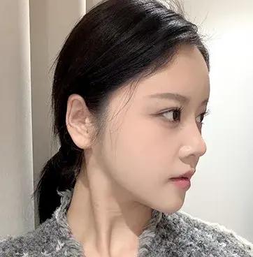 AFTER 3M