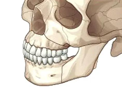 STEP 3. Repositioning of the Upper and Lower Jaws