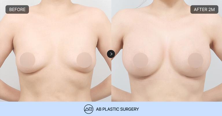 AB Plastic Surgery