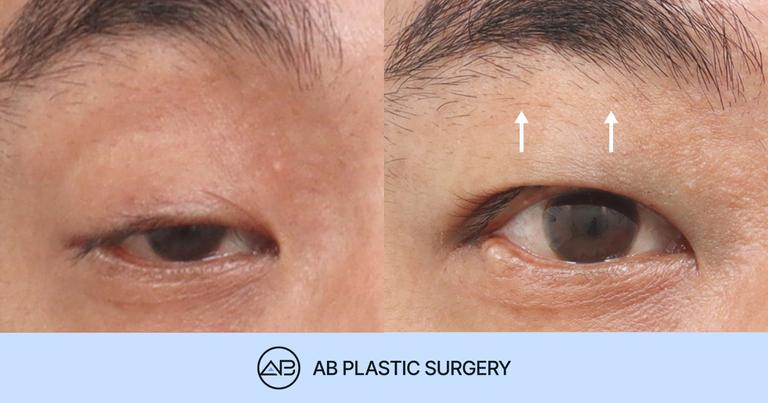 AB Plastic Surgery