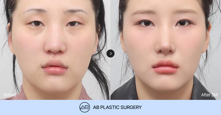 AB Plastic Surgery